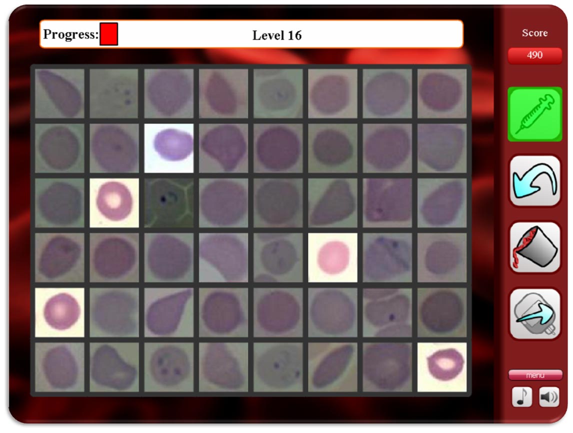 비전거는 온라인 크라우드 소싱을 사용하여 말라리아를 진단합니다
